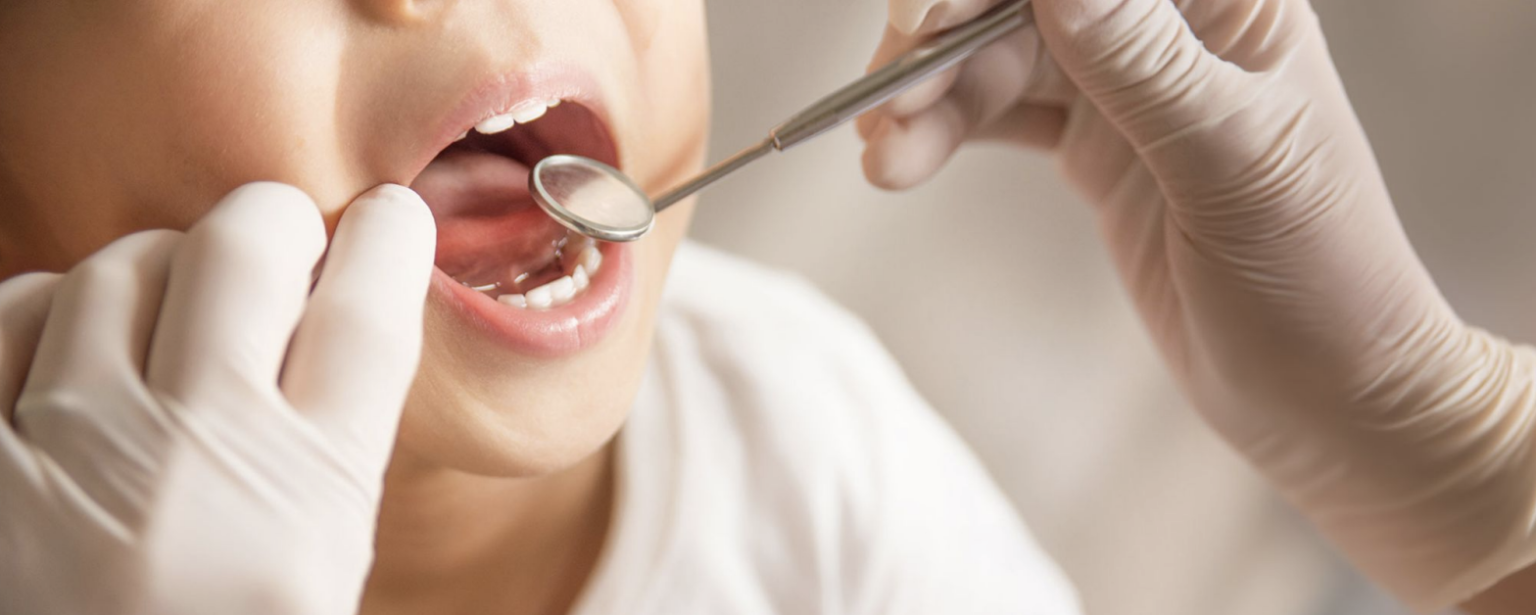 小児治療 用賀の歯医者・歯科｜スリーデンタルクリニック用賀｜世田谷で土日も営業｜インプラント｜小児歯科｜Three Dental